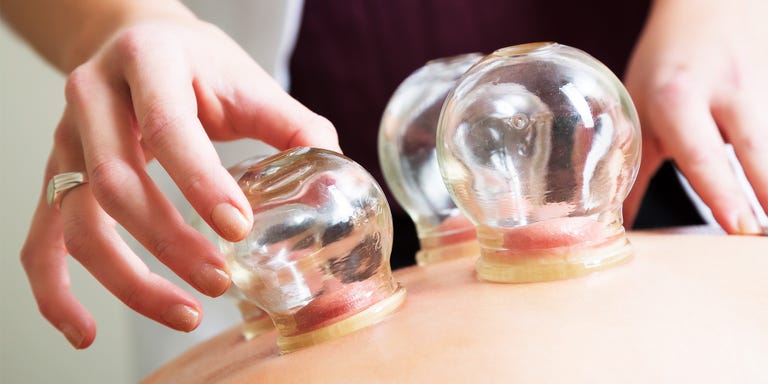 cupping