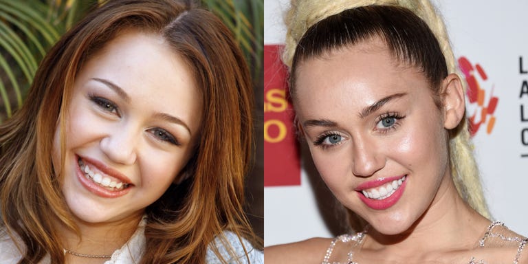 Celebrity Smiles Before and Afters - Celebrity Dental Work