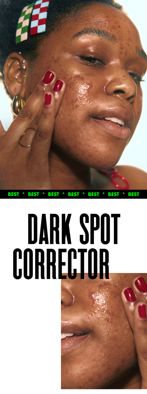 best darkspot corrector
