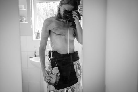 This breast cancer survivor documented her illness with a series of powerful photographs