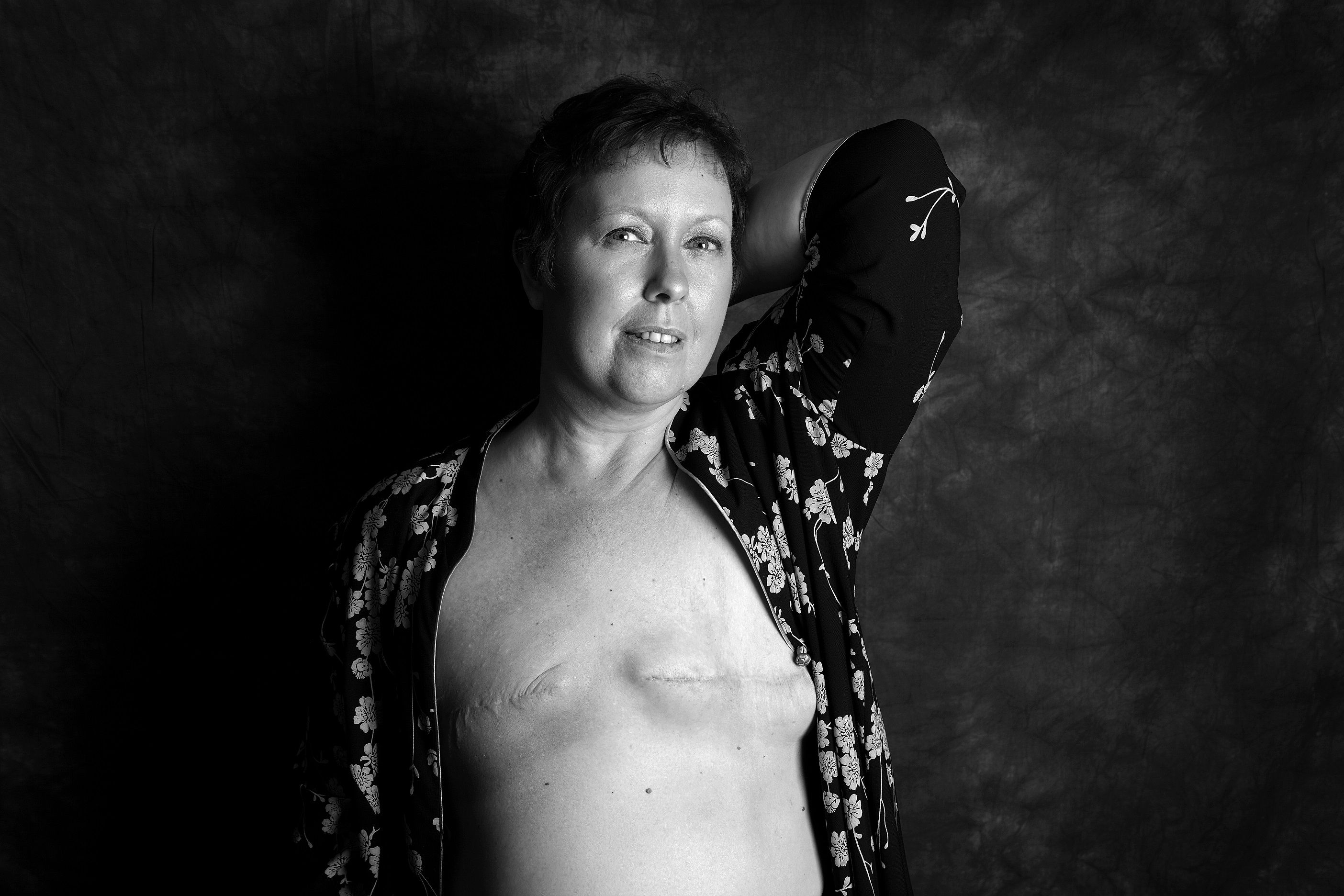 женщины с ампутированными грудями фото фото 7