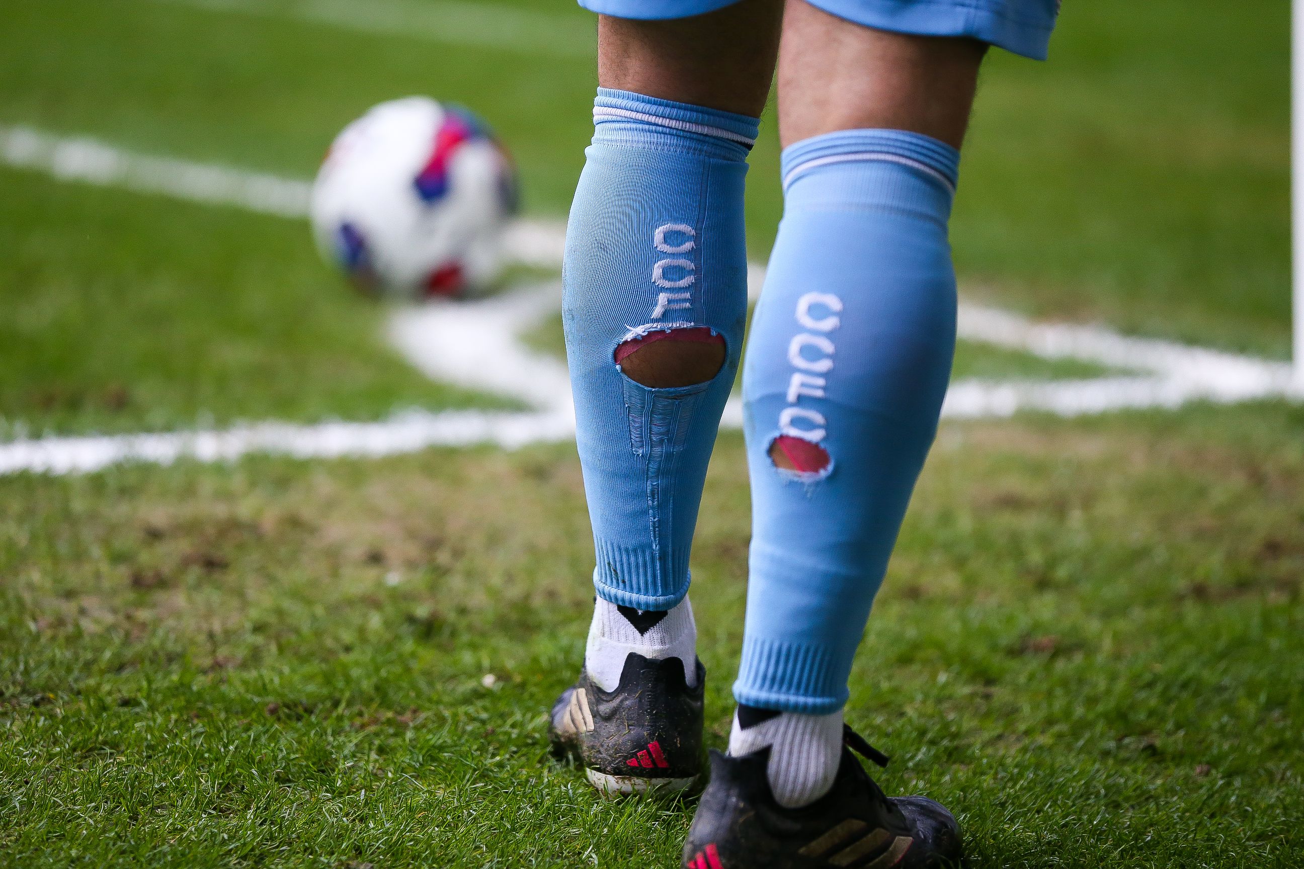 Springen dosis Sluit een verzekering af Wetenschap of waanzin: gaten in je voetbalsokken tegen kramp