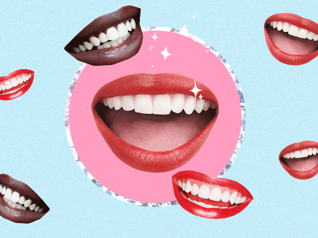 Blanqueamiento dental: todo lo que debes saber antes de hacerte uno