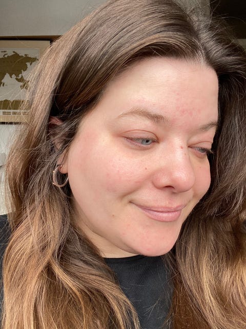 dr jart cicapair tiger grass colour correcting treatment review dr jart cicapair tiger grass colour correcting treatment review before after picture