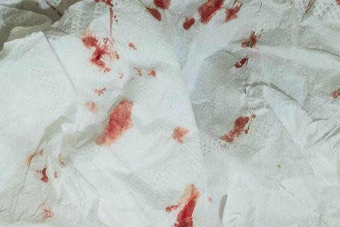 かゆく 赤い ぺ ない 斑点 ニス 写真で見る男性の性器カンジダ症の具体的な症状
