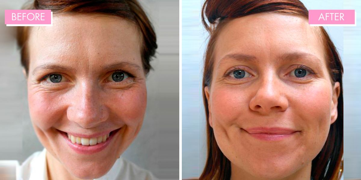 Heres What Drinking 3 Litres Of Water A Day Does To Your Skin