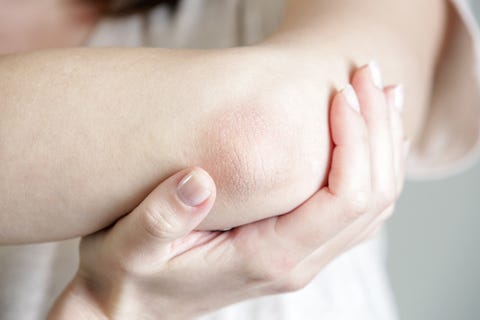 Humiliated about dull, harsh elbows? Humiliated about dull, harsh elbows?