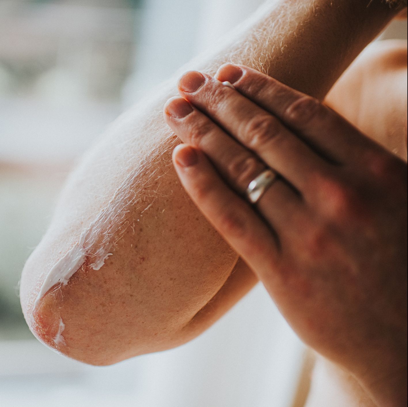 5 Signs You Might Be Suffering From More Than Just Dry Skin