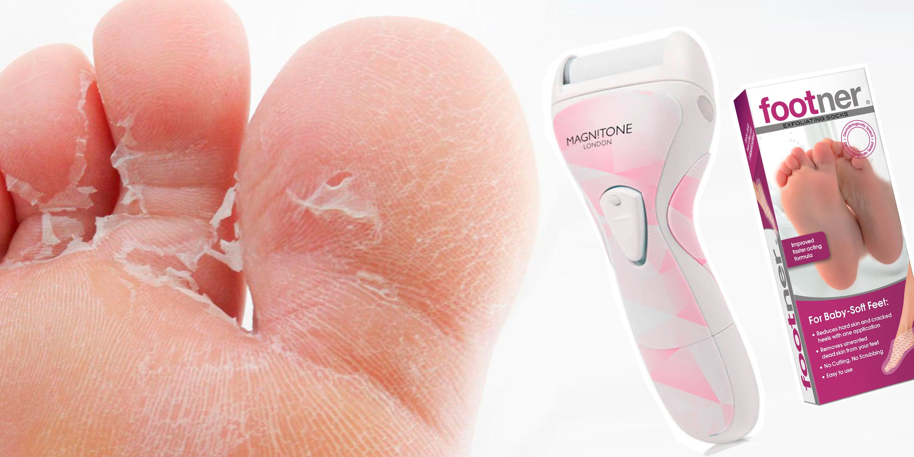 How to remove dry cracked skin from feet