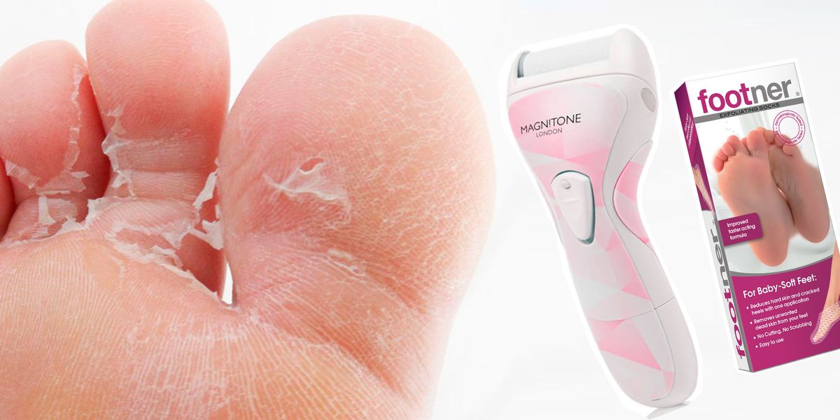 How to get rid of dry skin on feet: 6 gross-but-satisfying ways