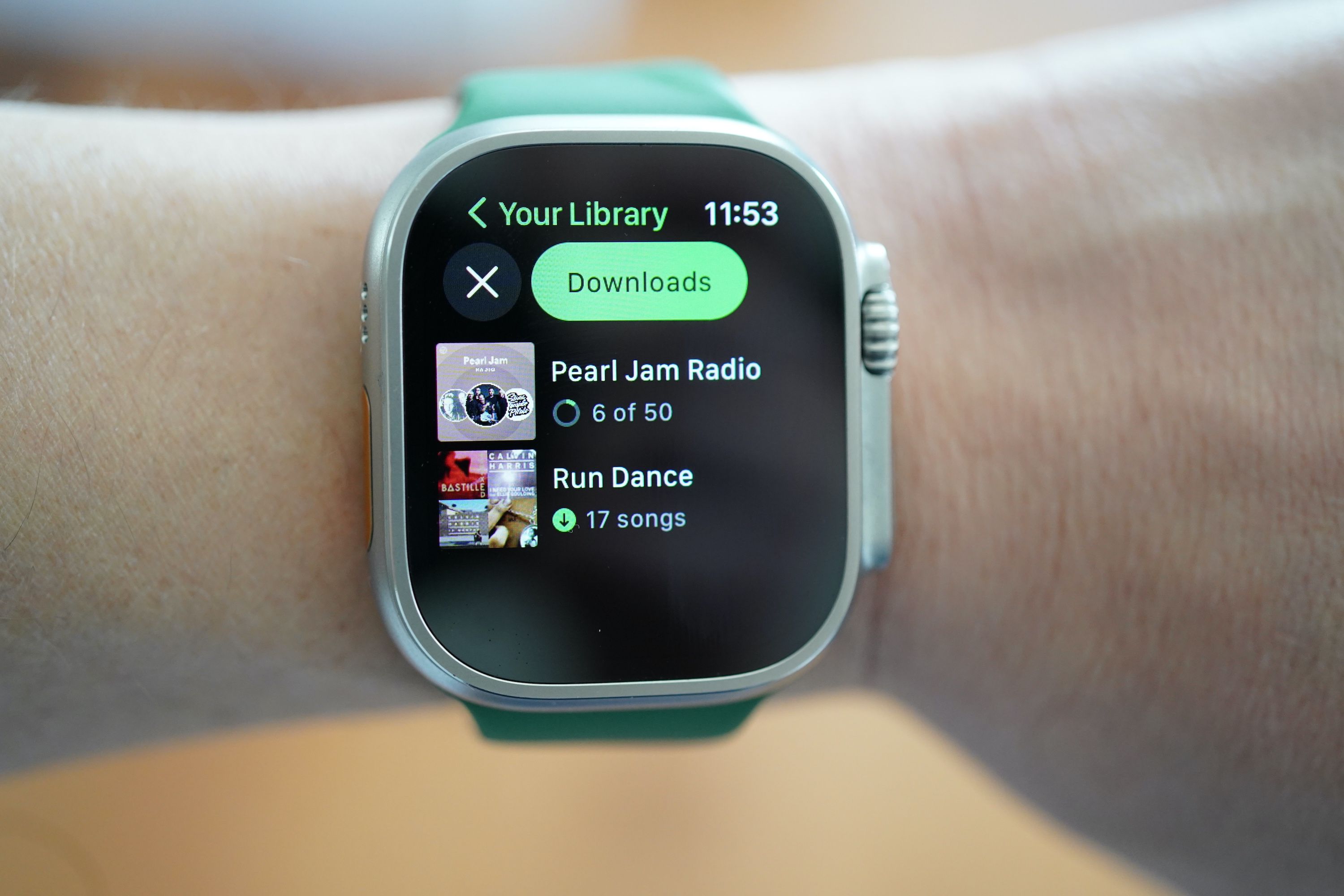 verstrickung-redundant-diskriminieren-apple-watch-7-spotify-r-ckschnitt