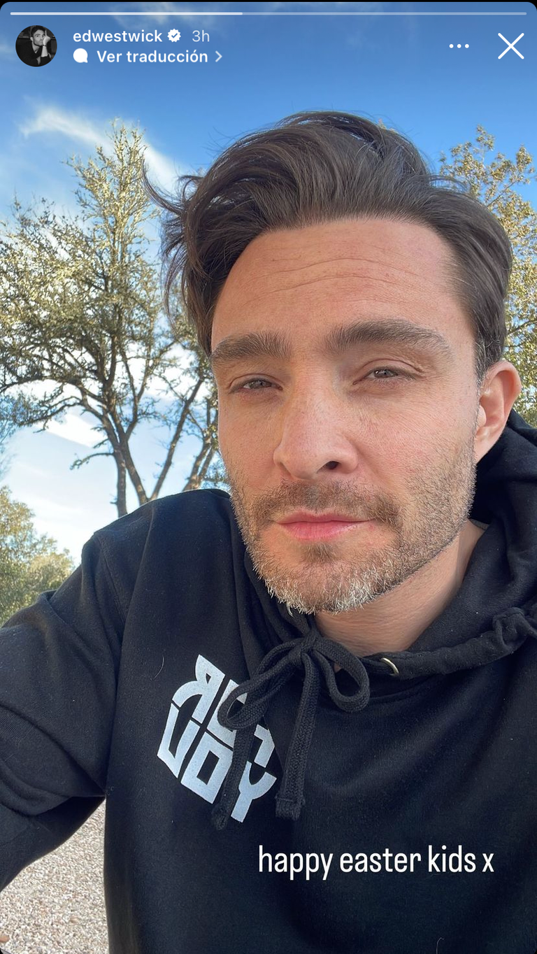 Ed Westwick’s photo showing the impressive physical change of the ‘Gossip Girl’ actor