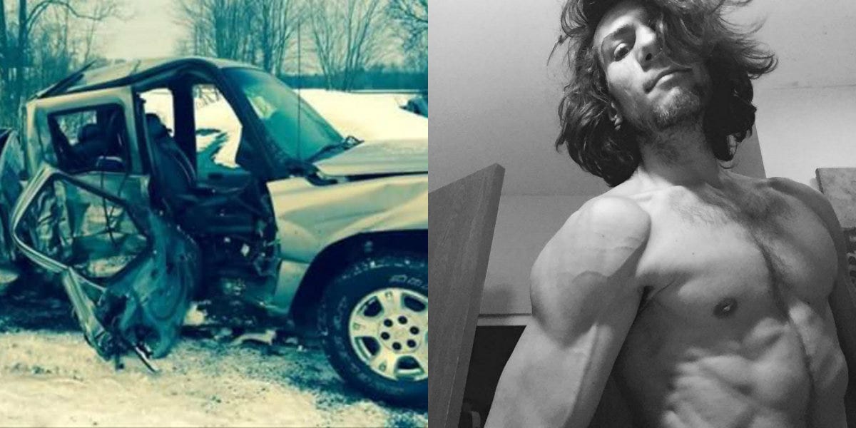 A Car Accident Broke This Guy's Entire Body. Bodybuilding Helped Him