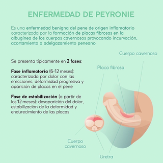 Andrology Of Barcelona Andrology Barcelona