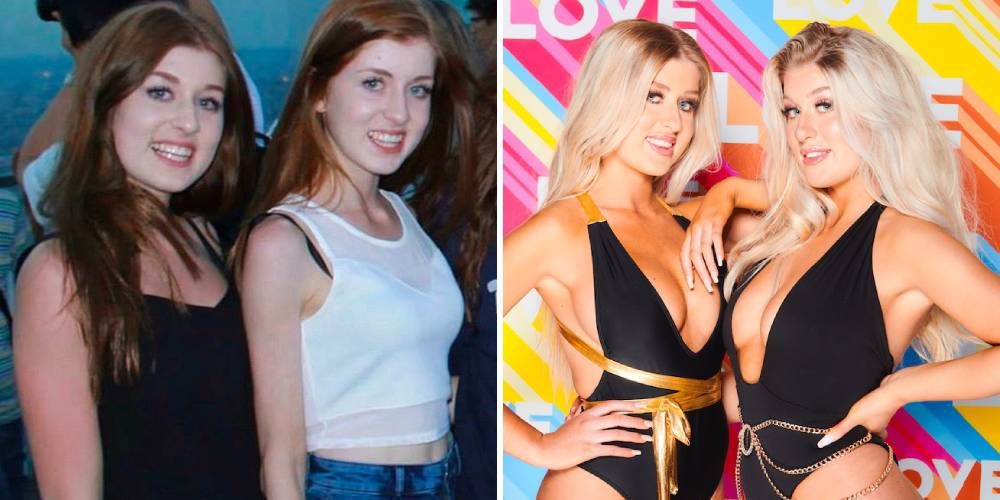 What Eve And Jess Gale Looked Like Before Love Island