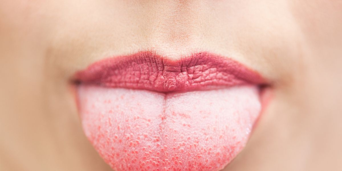 8 Causes Of Inflamed Swollen Taste Buds According To Doctors