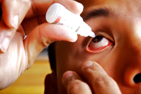 eye drops on dry eyes