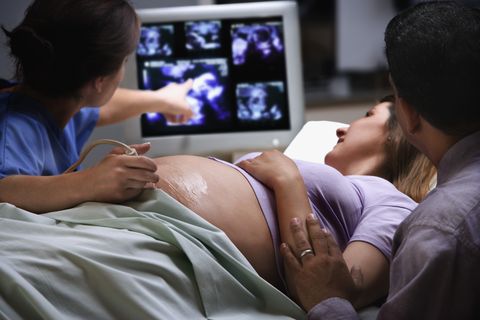mujer embarazada en ecografía con doctora y su pareja