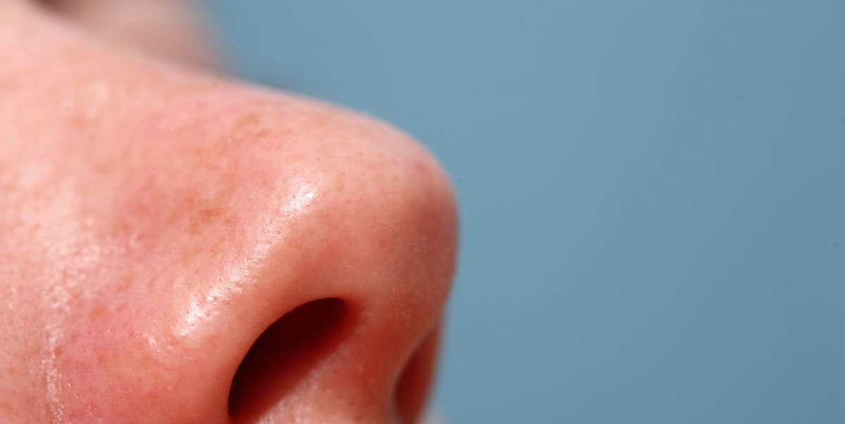 How To Get Rid Of Painful Pimples In Your Nose