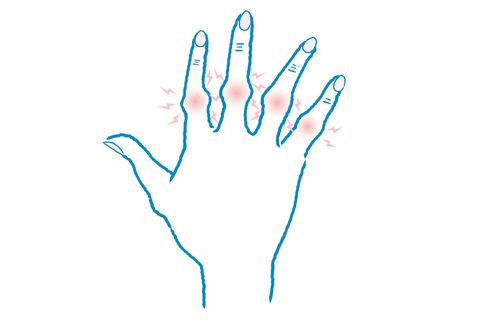 関節の痛み 手のこわばり 更年期特有の手指の悩みに答えます
