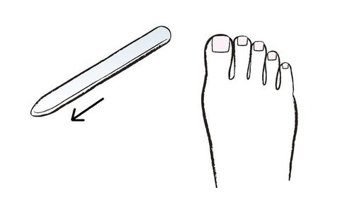 爪の切り方で巻き爪予防も 足トラブルを回避するセルフケア 足がよくつる人も必見です