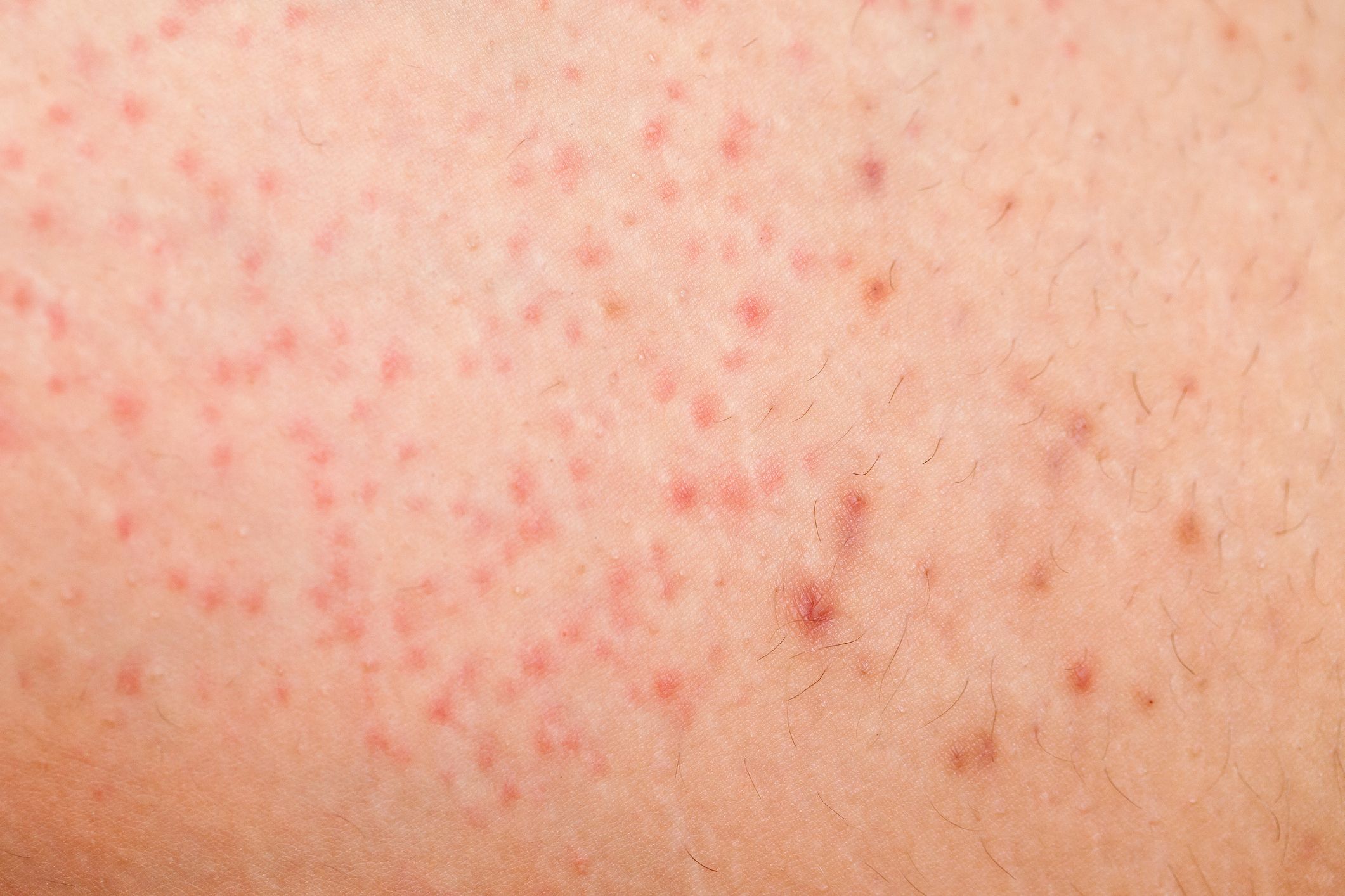 pinpoint red dots on arm