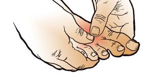 Plantar Fasciitis Release Technique