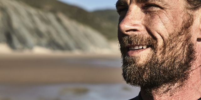 Las causas y las calvas en las barbas