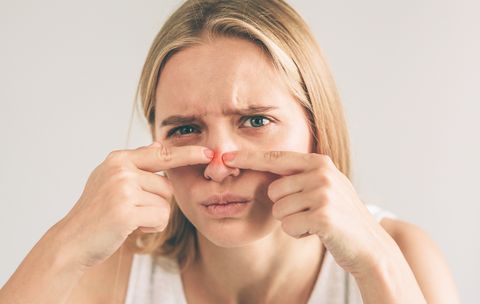 皮膚科医に聞く 赤くて痛い 鼻ニキビ の原因と治し方 カバーテク
