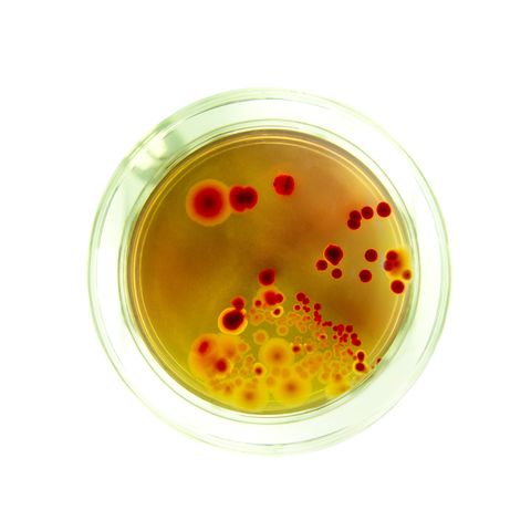 Bacterial culture