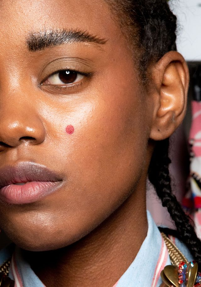 Minimize acne to overnight how 13 Powerful