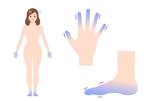 cold womans body, hand and foot set  blood circulation illustration sensitivity to cold