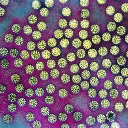 HPV is a contagious virus that can increase your risk for certain cancers. HPV is a contagious virus that can increase your risk for certain cancers.