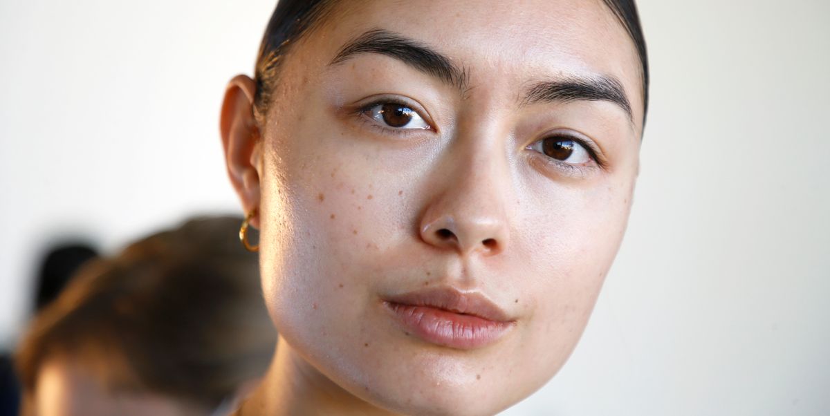 The Ultimate Guide To Adult Acne