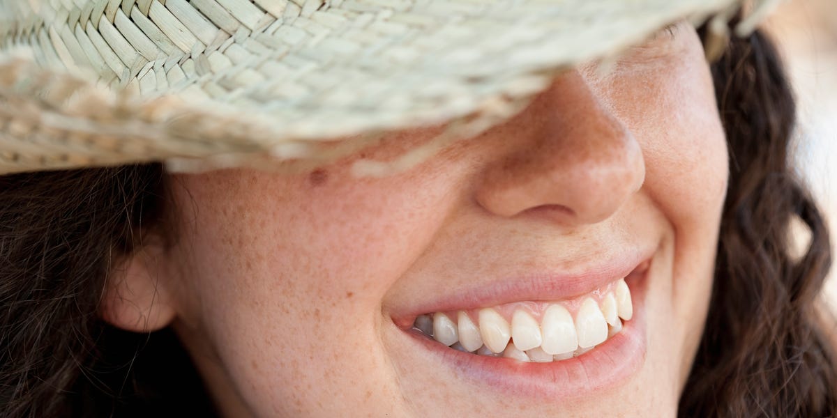 The Best Ways To Remove Age Spots The Best Ways To Remove Age Spots