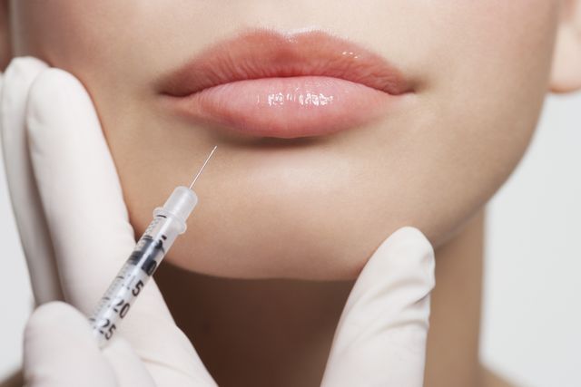 woman receiving lip injections