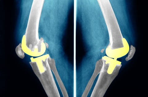 knee surgery