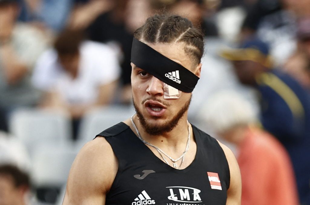 French Hurdler Punched in the Eye 20 Minutes Before the Race Goes on to Win