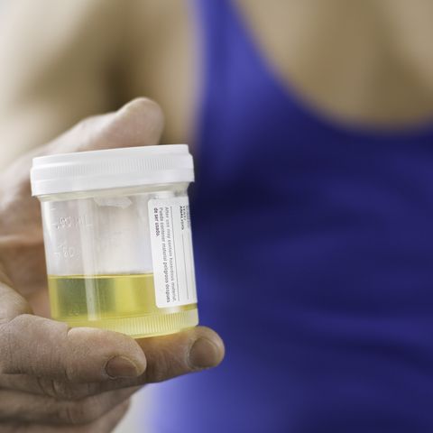 Pee is for Pregnant: The history and science of urine-based