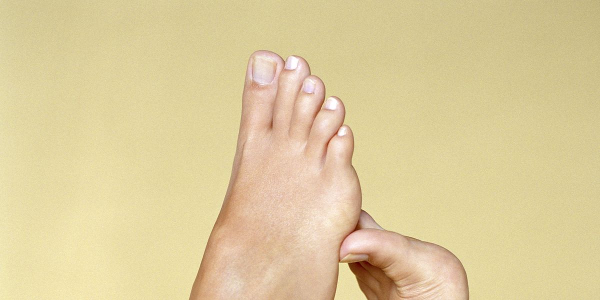 How To Heal Cracked Heels In 4 Steps, According To A Podiatrist