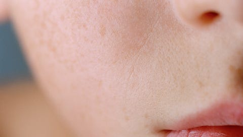 我是敏感肌嗎 皮膚科醫師一次釐清 敏感肌症狀 原因 如何改善 我是敏感肌嗎 皮膚科醫師一次釐清 敏感肌症狀 原因 如何改善