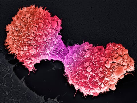 Pancreatic cancer cells completing division.