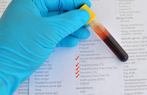 tsh blood test