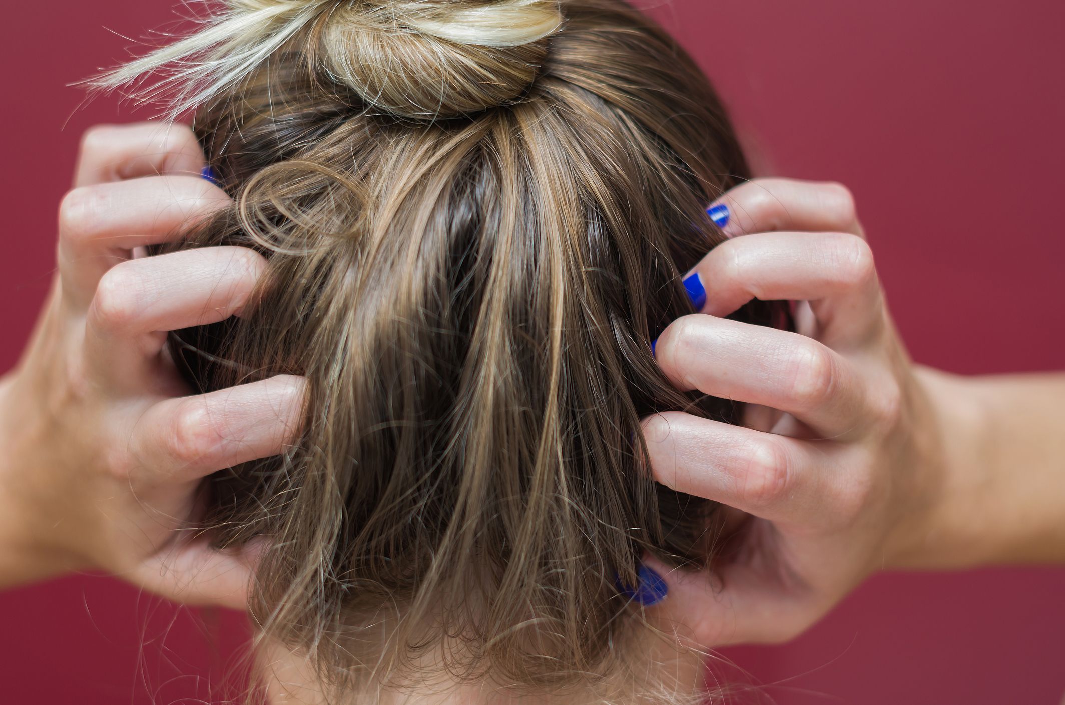 10 Reasons Your Scalp Might Be Itchy And What To Do About It