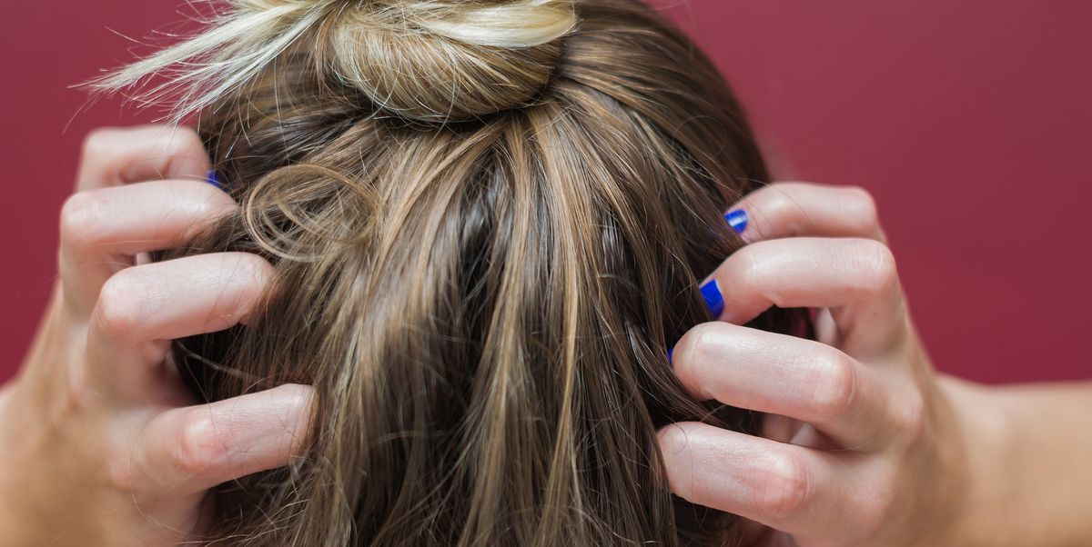 10 Reasons Your Scalp Might Be Itchy — And What to Do 