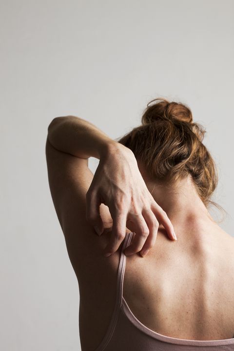 model released woman scratching her itchy back