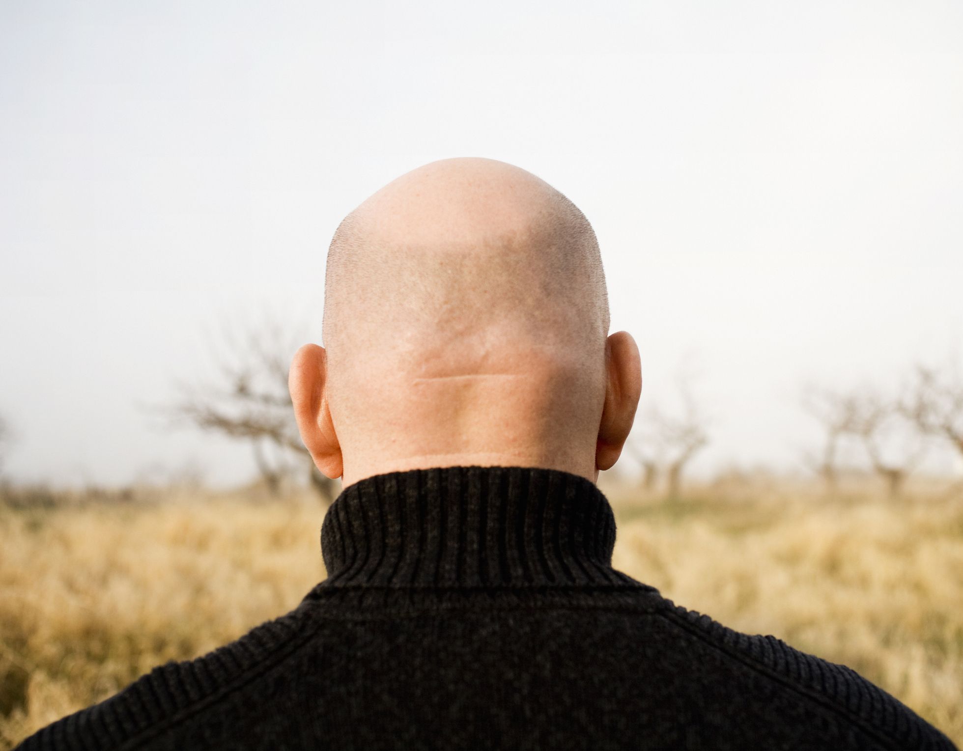 Man without hair on head