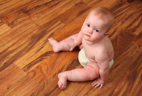 Unhappy baby with a rash sits on a wooden floor