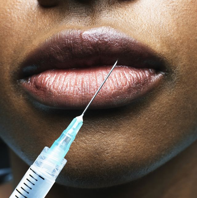 young woman receiving injection in lip, close up