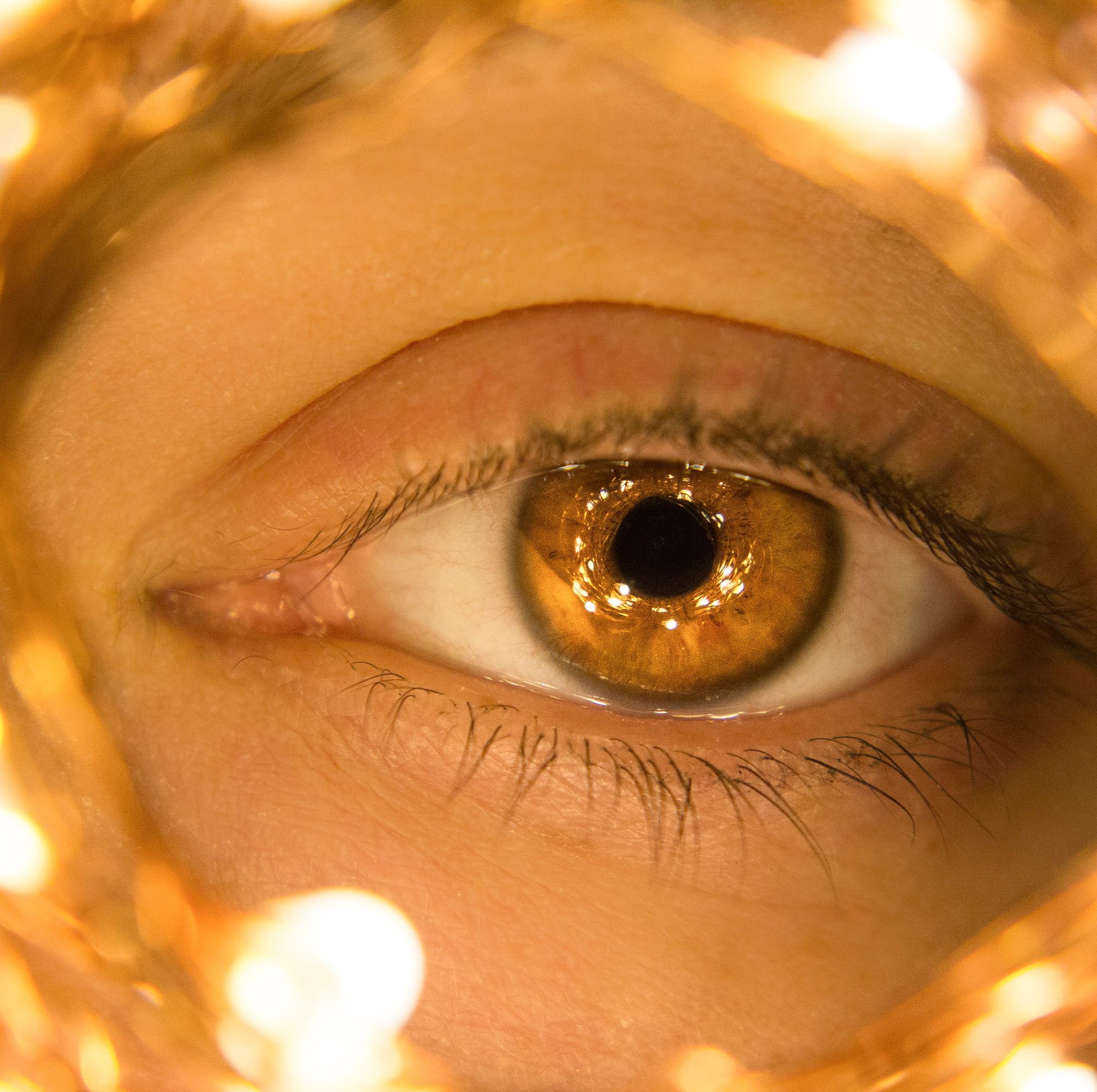 Scientists May Have Discovered a Possible Treatment for Blindness: Gold